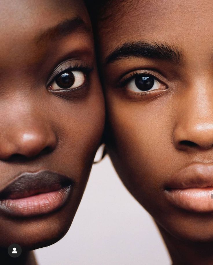 Éviter l’effet gris sur les peaux mates : causes et solutions